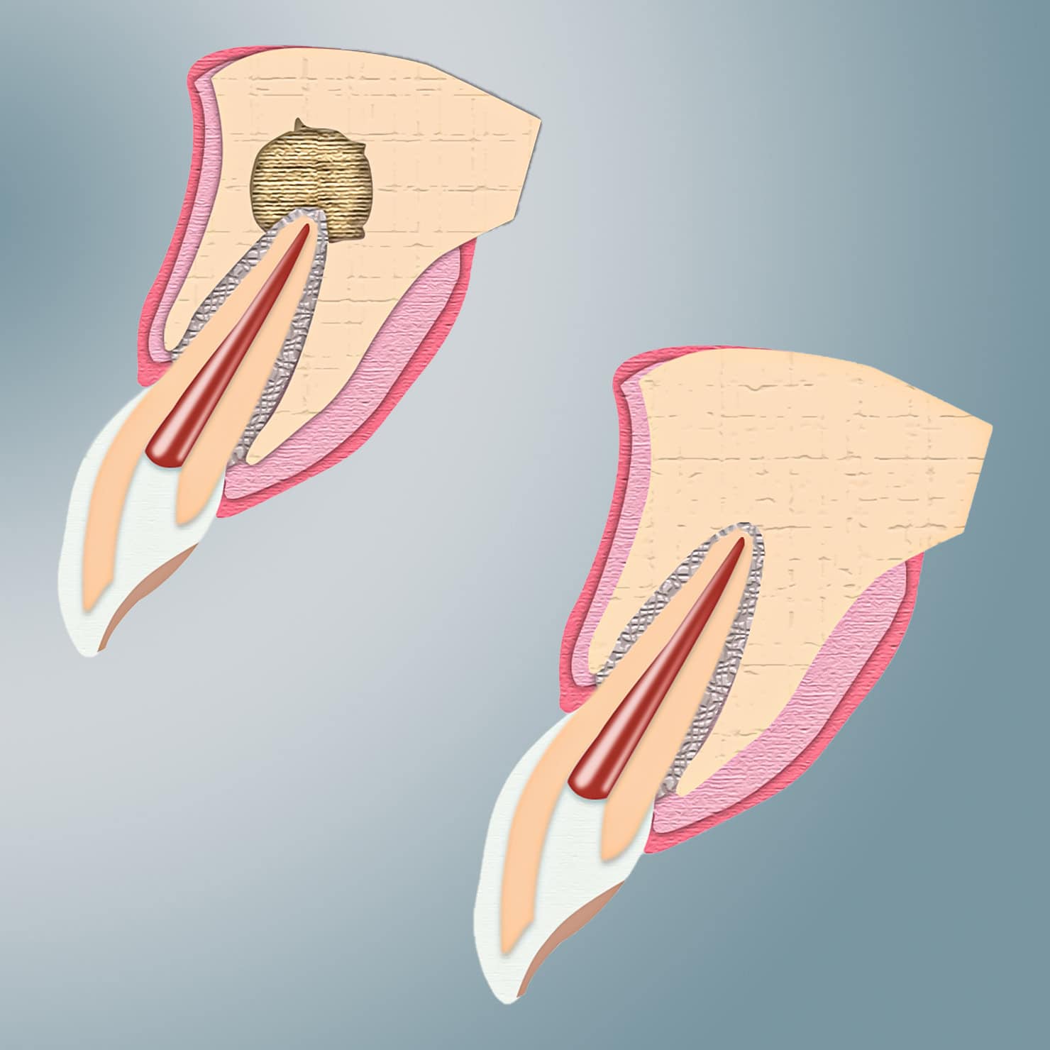 procedure